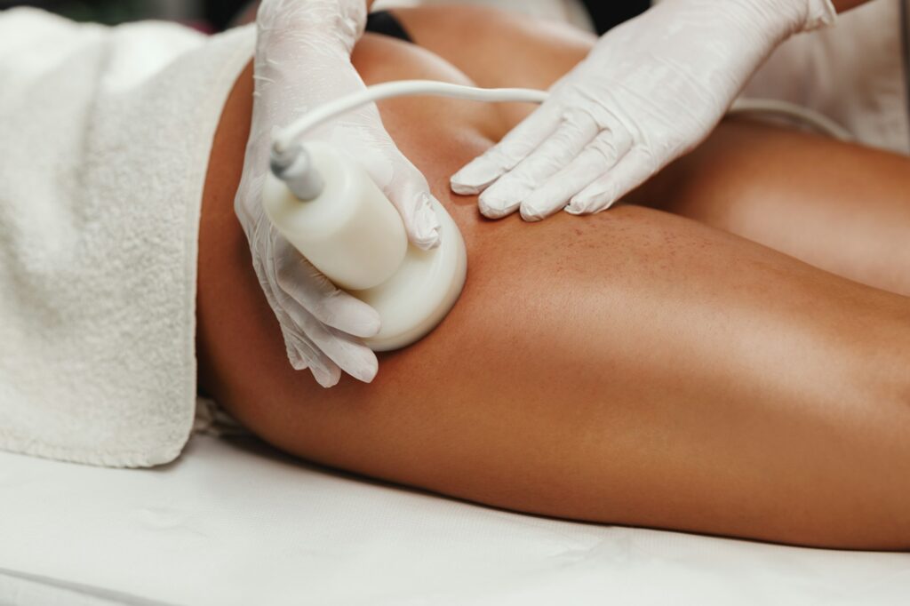 Ultrasound Cavitation Body Contouring Treatment