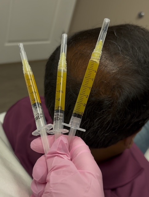 PRP/PRF Injections