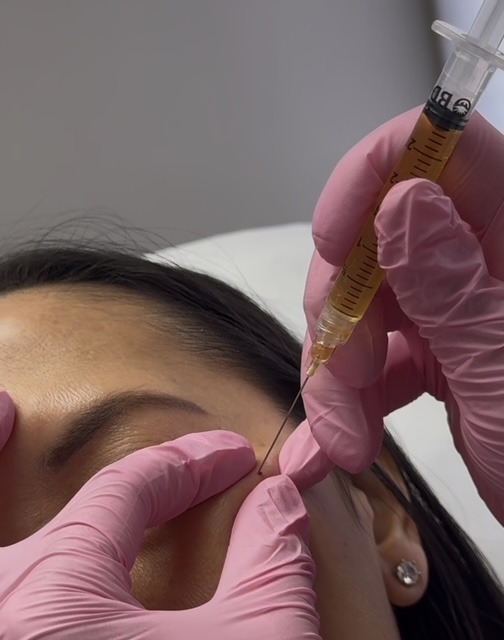 PRP/PRF Injections